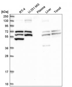 Anti-TXNRD1 antibody produced in rabbit 