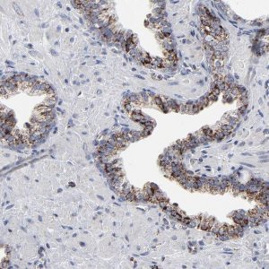 Anti-TXNRD2 antibody produced in rabbit HPA003323-100UL