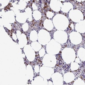Anti-TXNRD3NB antibody produced in rabbit 