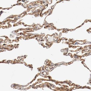 Anti-TYK2 antibody produced in rabbit 