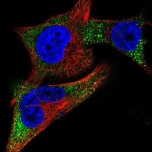Anti-TYR antibody produced in rabbit 