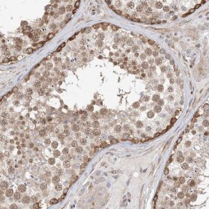 Anti-TYSND1 antibody produced in rabbit 