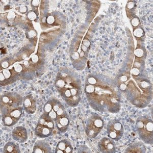 Anti-TYSND1 antibody produced in rabbit 