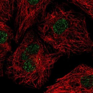 Anti-U2AF1L4 antibody produced in rabbit 