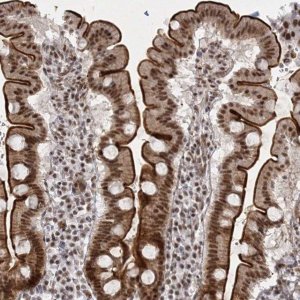 Anti-U2SURP antibody produced in rabbit HPA037545-100UL