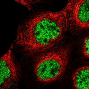 Anti-U2SURP antibody produced in rabbit HPA037545-100UL