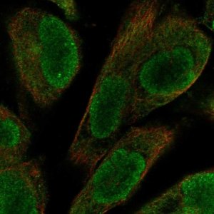 Anti-UACA antibody produced in rabbit 