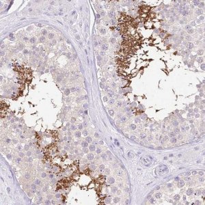Anti-UBA6 antibody produced in rabbit 