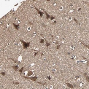 Anti-UBAC1 antibody produced in rabbit 