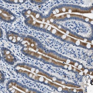 Anti-UBAC2 antibody produced in rabbit 