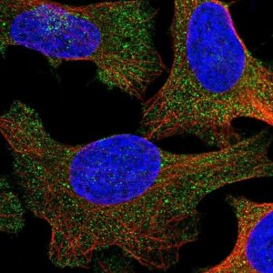 Anti-UBAP1 antibody produced in rabbit 