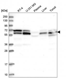 Anti-UBAP1 antibody produced in rabbit 