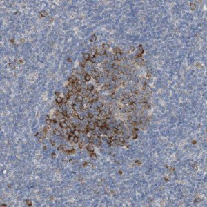 Anti-UBAP2 antibody produced in rabbit 
