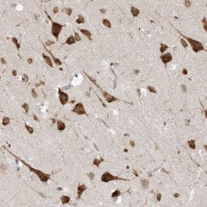 Anti-UBAP2L antibody produced in rabbit 