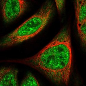 Anti-UBAP2L antibody produced in rabbit 