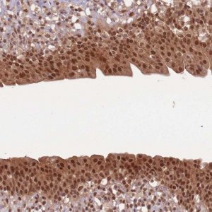 Anti-UBB antibody produced in rabbit 