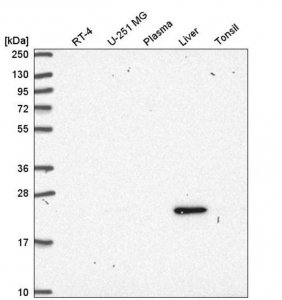 Anti-UBB antibody produced in rabbit 