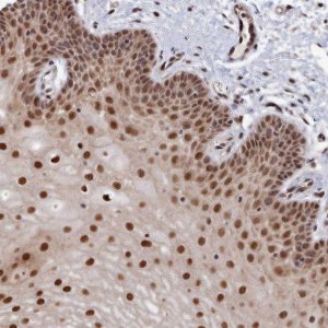 Anti-UBC antibody produced in rabbit HPA041344-100UL