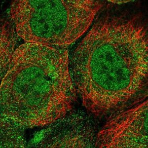 Anti-UBE2A antibody produced in rabbit 