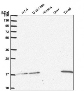 Anti-UBE2A antibody produced in rabbit 