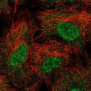 Anti-UBE2B antibody produced in rabbit 