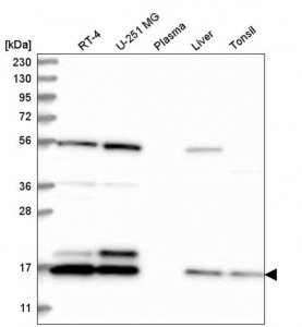Anti-UBE2C antibody produced in rabbit 