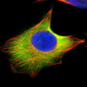 Anti-UBE2D2 antibody produced in rabbit HPA003920-100UL