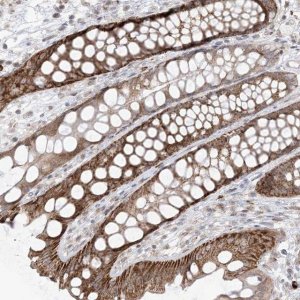 Anti-UBE2E2 antibody produced in rabbit 