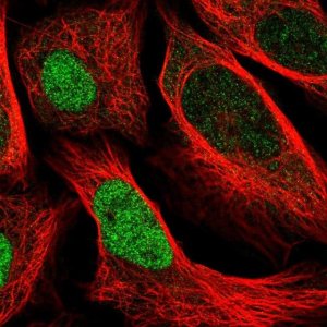 Anti-UBE2E2 antibody produced in rabbit 