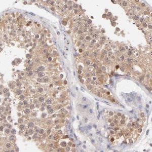 Anti-UBE2E3 antibody produced in rabbit 