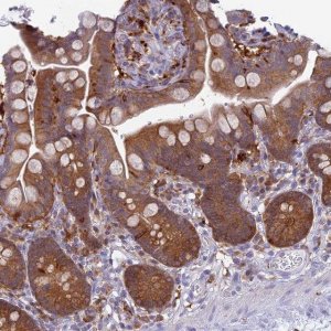 Anti-UBE2G1 antibody produced in rabbit HPA045681-100UL