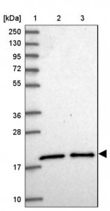 Anti-UBE2G1 antibody produced in rabbit HPA045681-100UL