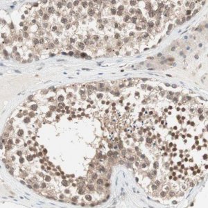 Anti-UBE2I antibody produced in rabbit 