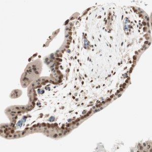 Anti-UBE2I antibody produced in rabbit 