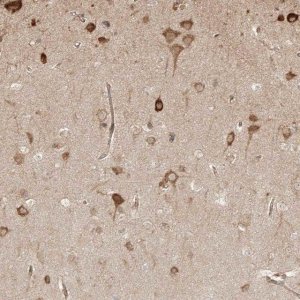 Anti-UBE2K antibody produced in rabbit 