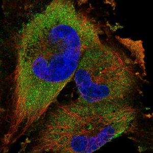 Anti-UBE2K antibody produced in rabbit 