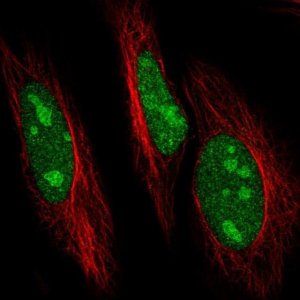 Anti-UBE2R2 antibody produced in rabbit HPA061000-100UL