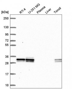 Anti-UBE2R2 antibody produced in rabbit HPA061000-100UL