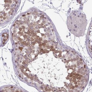 Anti-UBE2S antibody produced in rabbit 