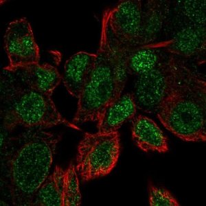 Anti-UBE2V1 antibody produced in rabbit 