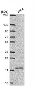 Anti-UBE2V1 antibody produced in rabbit 