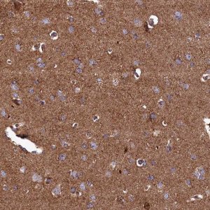 Anti-UBE3B antibody produced in rabbit 