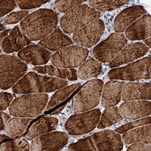Anti-UBE3C antibody produced in rabbit 