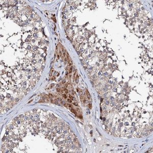 Anti-UBE3C antibody produced in rabbit 