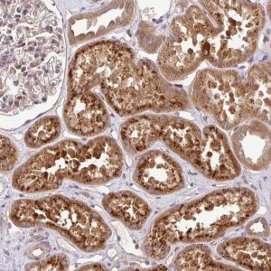 Anti-UBE4A antibody produced in rabbit 