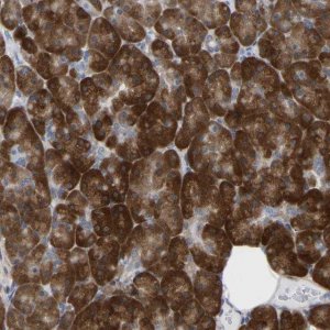 Anti-UBE4B antibody produced in rabbit 