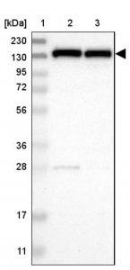 Anti-UBE4B antibody produced in rabbit 