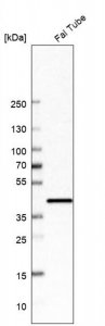 Anti-UBIAD1 antibody produced in rabbit 