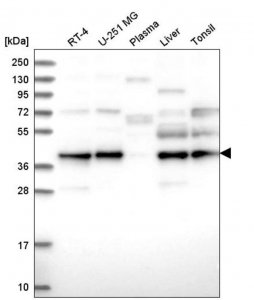 Anti-UBL7 antibody produced in rabbit 