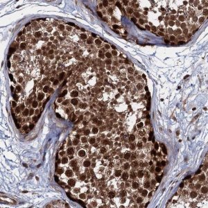 Anti-UBLCP1 antibody produced in rabbit 